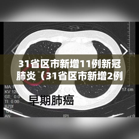 31省区市新增11例新冠肺炎（31省区市新增2例新冠）