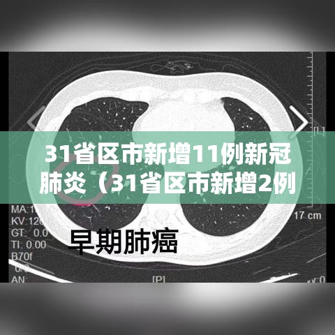 31省区市新增11例新冠肺炎（31省区市新增2例新冠）