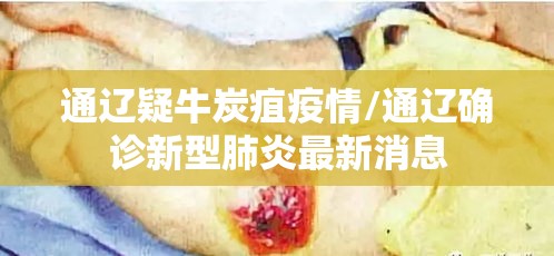 通辽疑牛炭疽疫情/通辽确诊新型肺炎最新消息