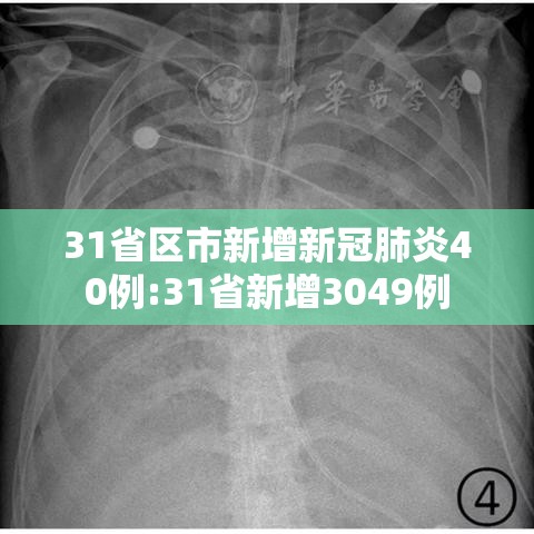 31省区市新增新冠肺炎40例:31省新增3049例 31省区市新增新冠肺炎40例:31省新增3049例
