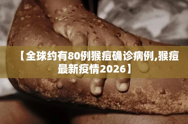 【全球约有80例猴痘确诊病例,猴痘最新疫情2026】