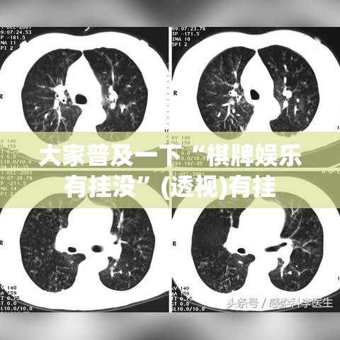 大家普及一下“棋牌娱乐有挂没”(透视)有挂